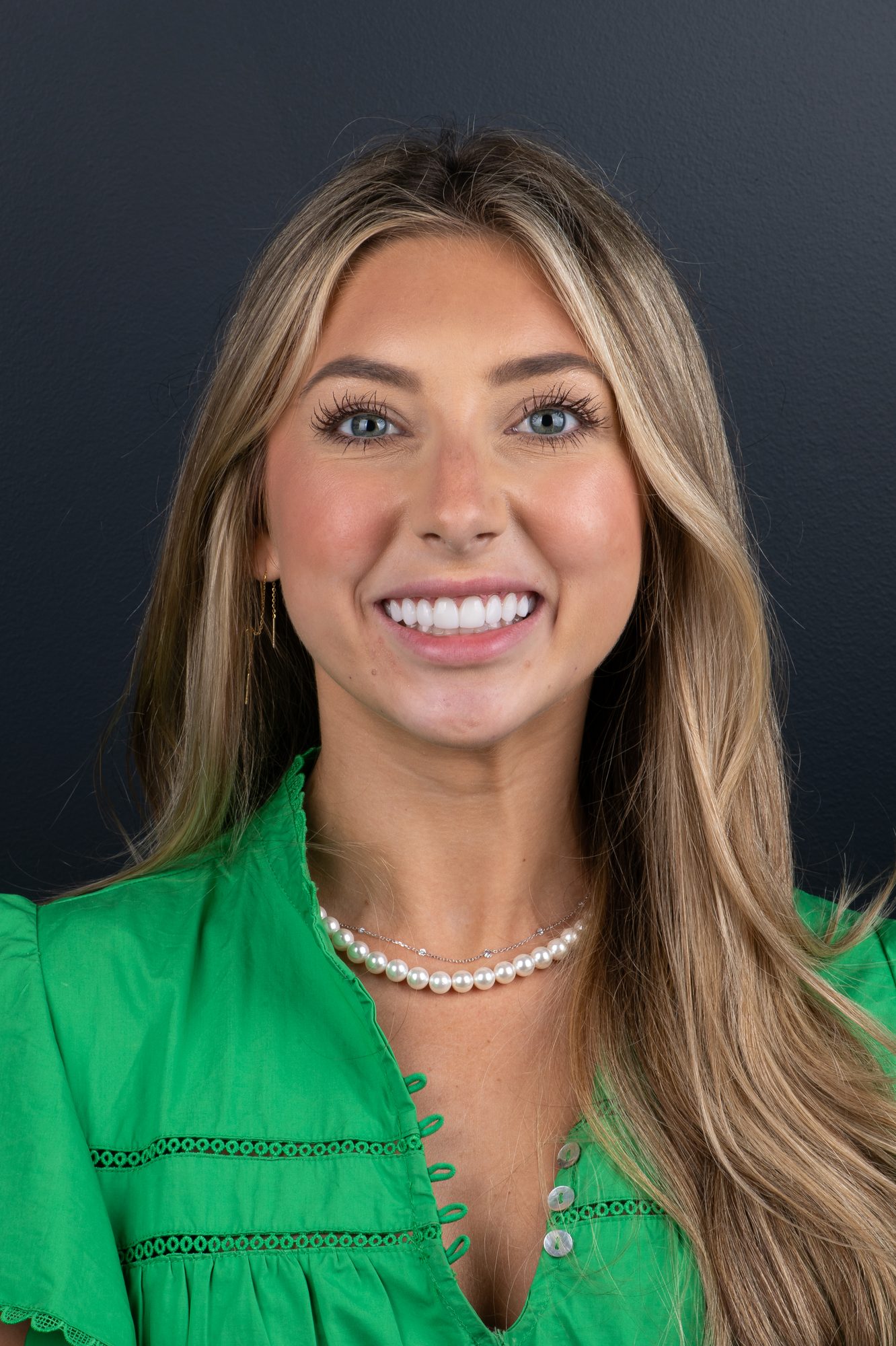 The same patient's smile after her PERL veneer makeover, brighter and more even