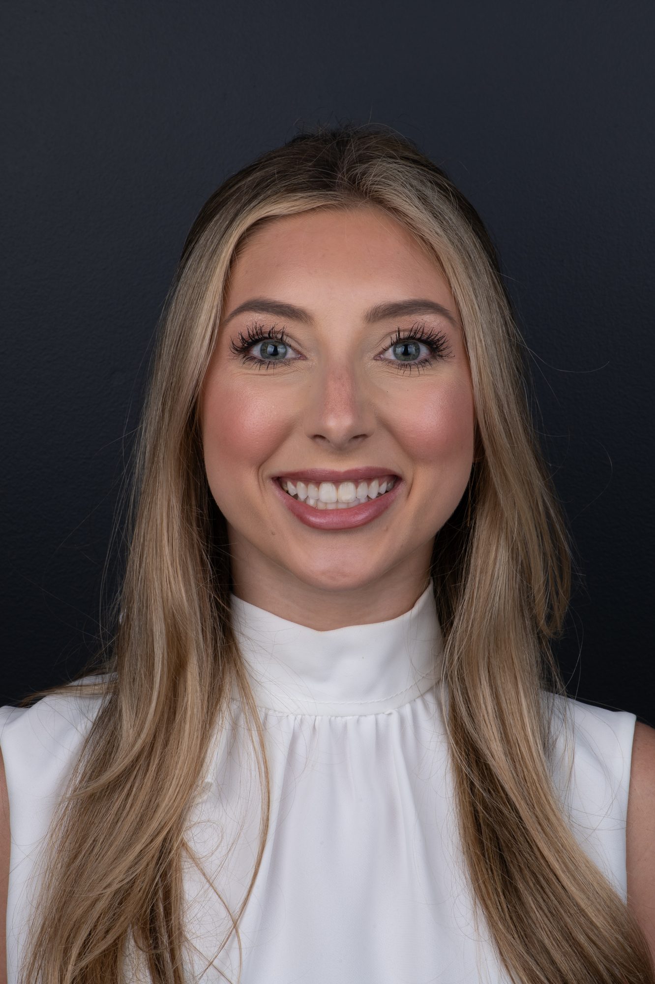 A patient's smile before her PERL veneer makeover at Smile On Nashville