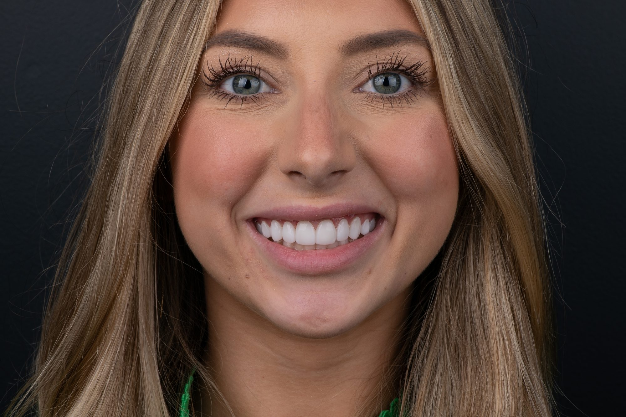 A patient's finished PERL smile on a dark studio background