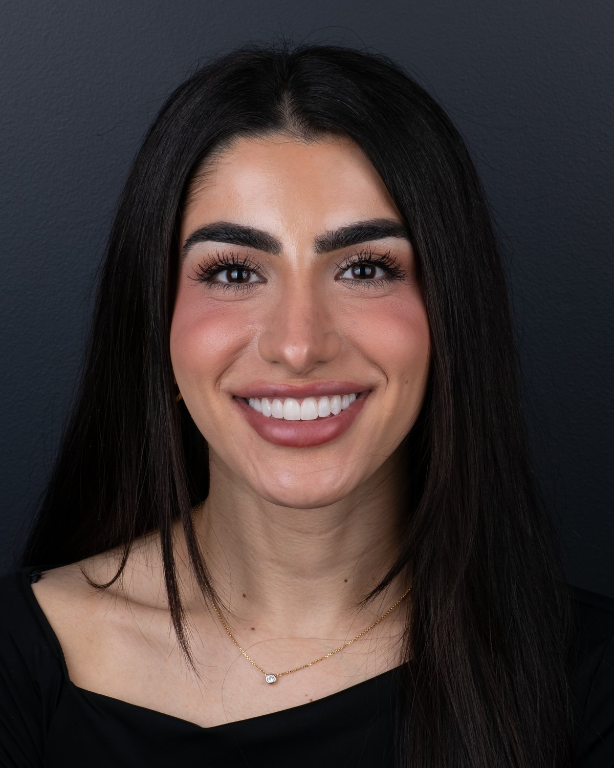 Same patient after her full-smile Printed PERL Veneer makeover, with brighter color and balanced proportions