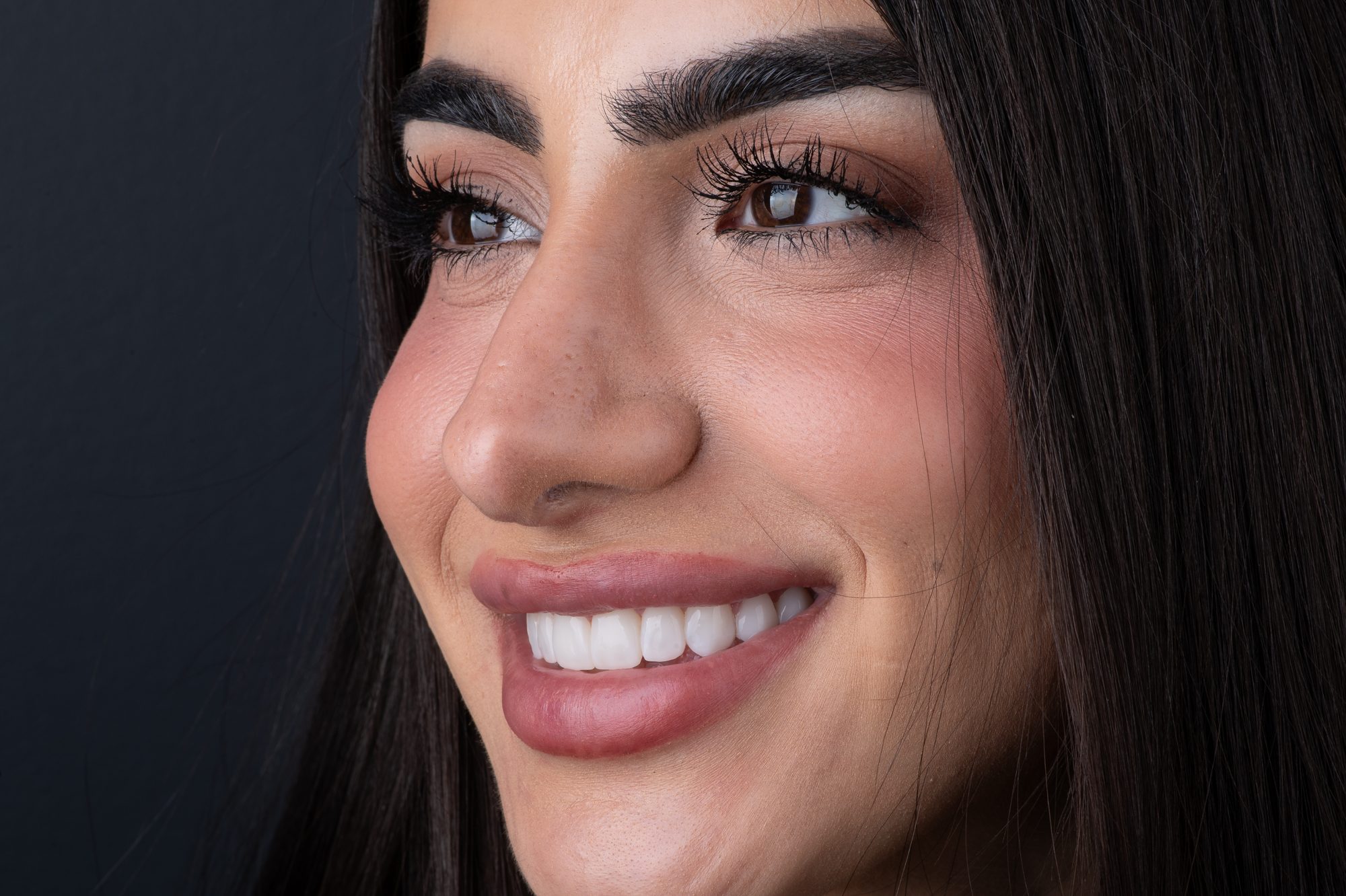 A Smile On Nashville patient smiling with PERL 3D printed veneers on a dark studio background