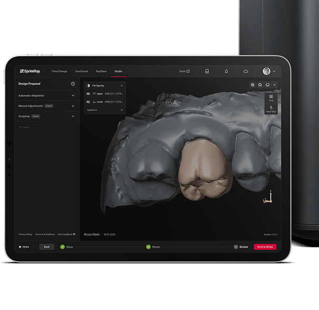 Digital smile design software showing a 3D model