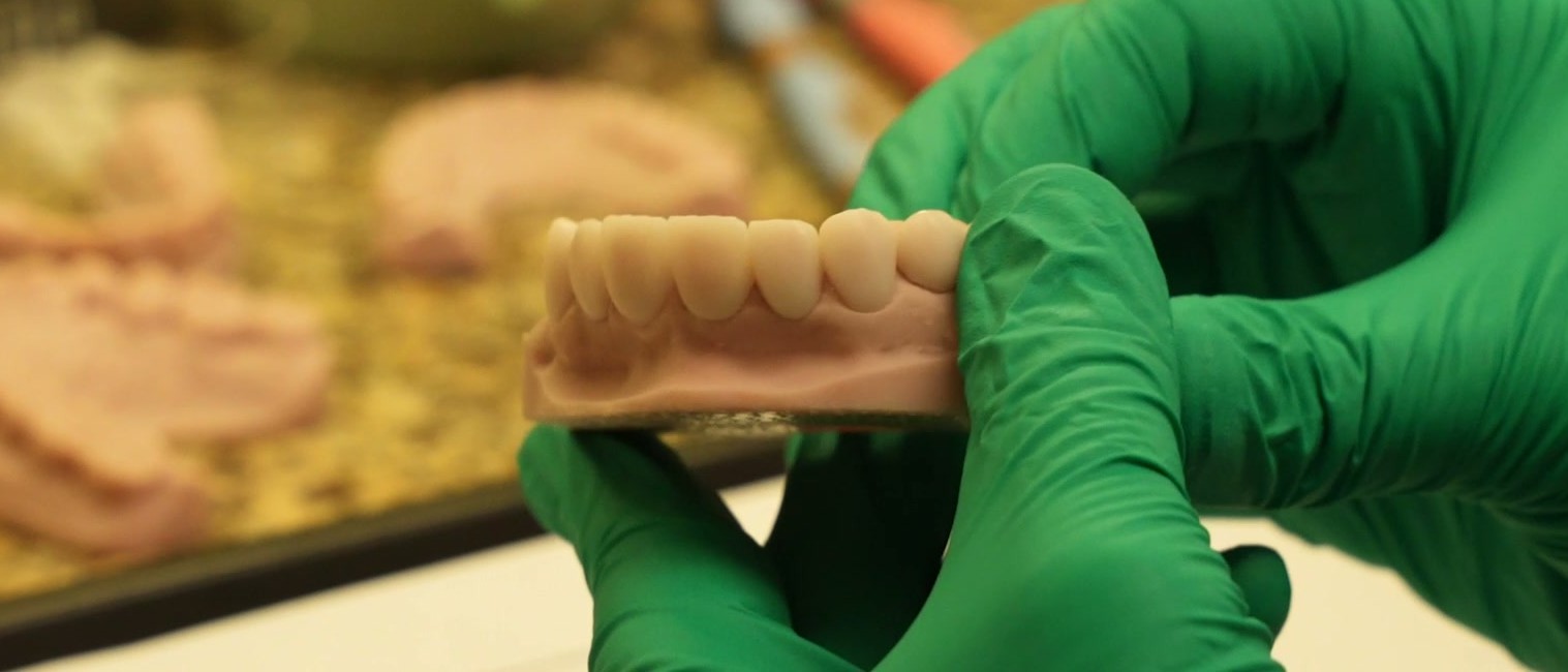 A finished arch checked by hand at the in-house digital lab bench at Smile On Nashville