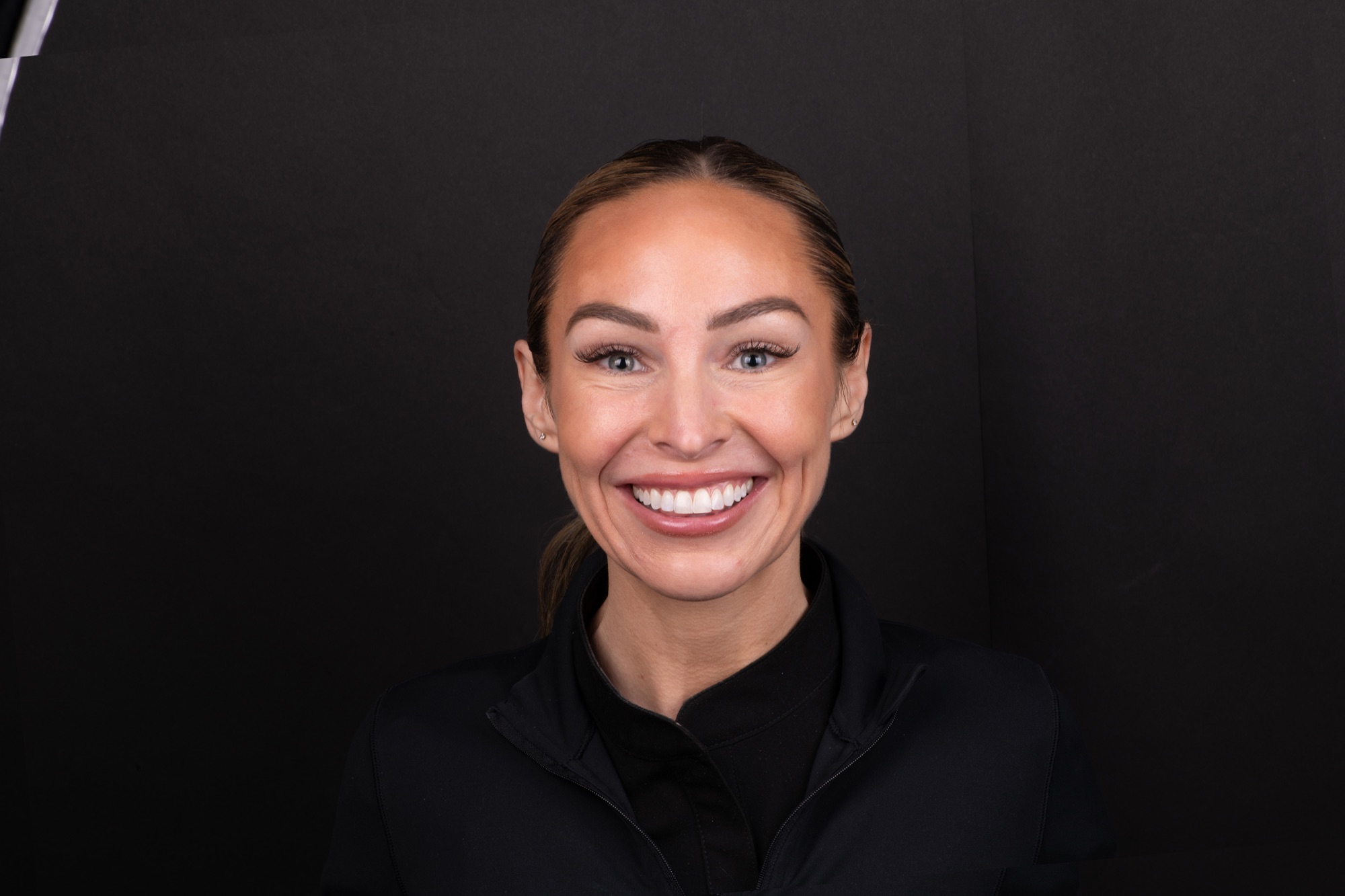 Close-up of a bright, healthy smile after veneer treatment at Smile On Nashville